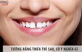 Người Răng Thưa Thì Sao